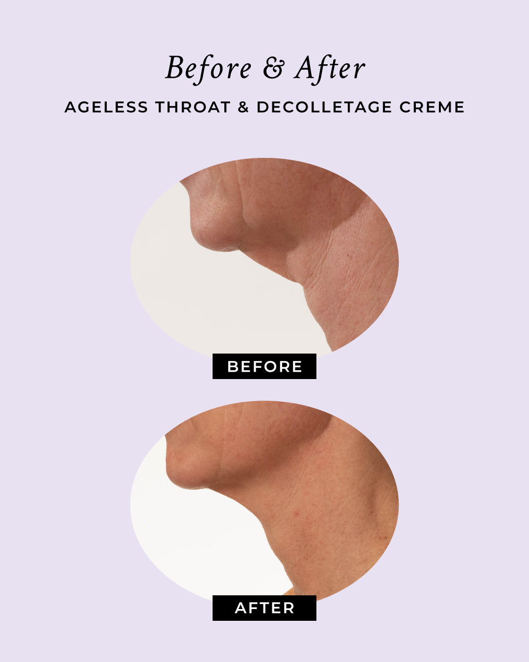 Ageless Throat & Decolletage Anti-Aging Neck Creme