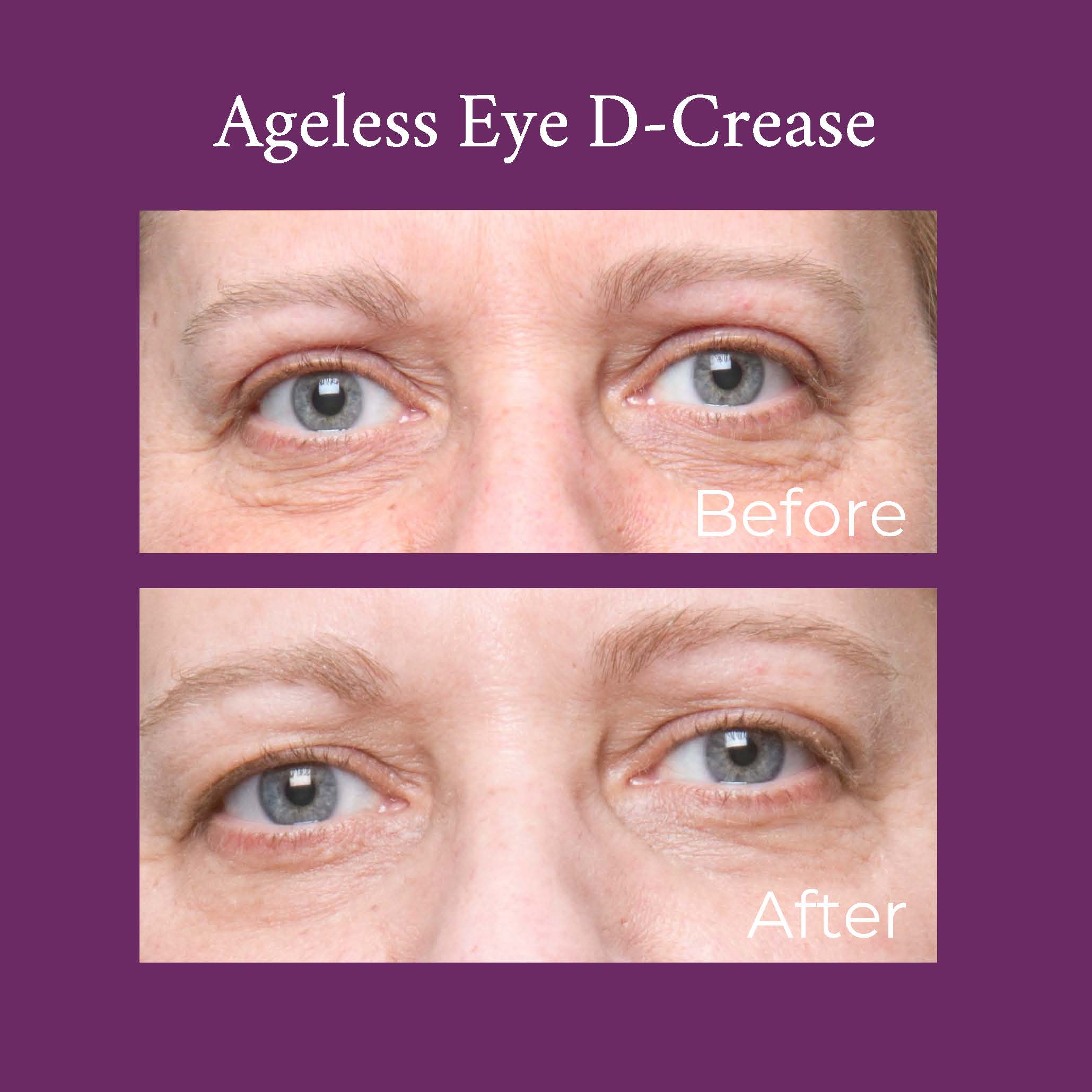 Ageless Eye D-Crease – PRAI Beauty